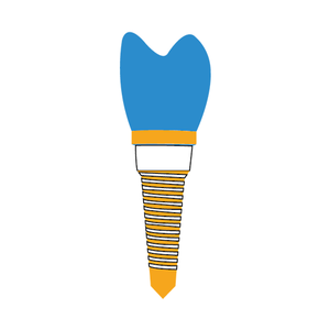 Implantes dentales