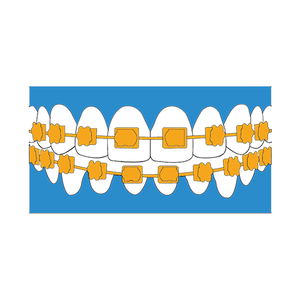 Ortodoncia e Invisalign