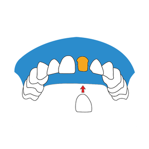 Rehabilitación oral