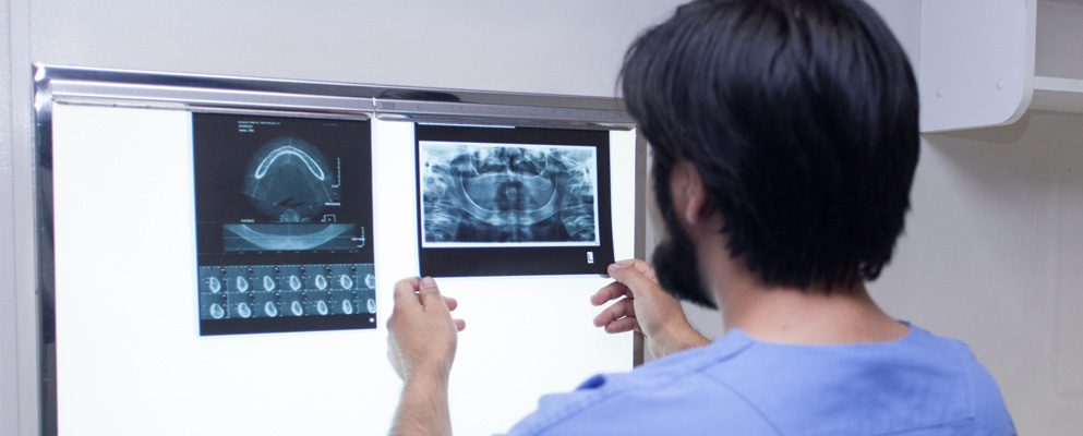 Rehabilitación oral